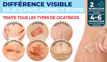 Dr.Fachmer® 👩‍⚕️ Patch Réparateur Bio-Régénérant à Micro-Aiguilles pour Cicatrices – Soin Avancé au Collagène & Silicone