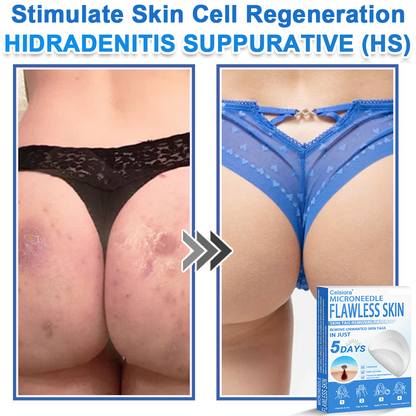 👩‍⚕️ Celsiora® 2-in-1 Microneedle & Hydrocolloid Patch | Raised Moles,Acne,  Flat Warts & Skin Tags Remover | Improves Wrinkles, Scars & Blemishes | Invisible Pimple Patches for Face & Body