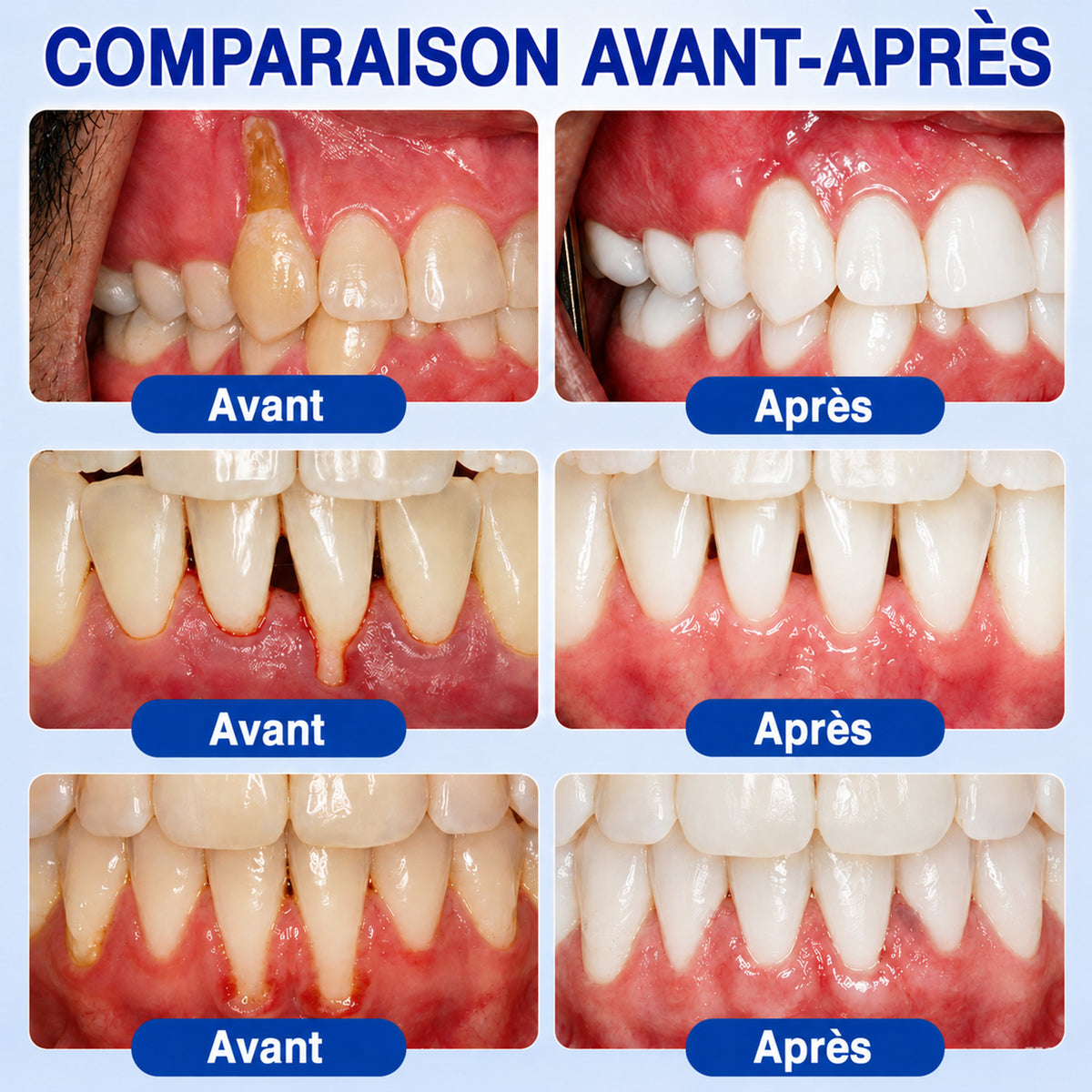 Profitez de 20 % de réduction sur le 2ᵉ article 🧡🧡