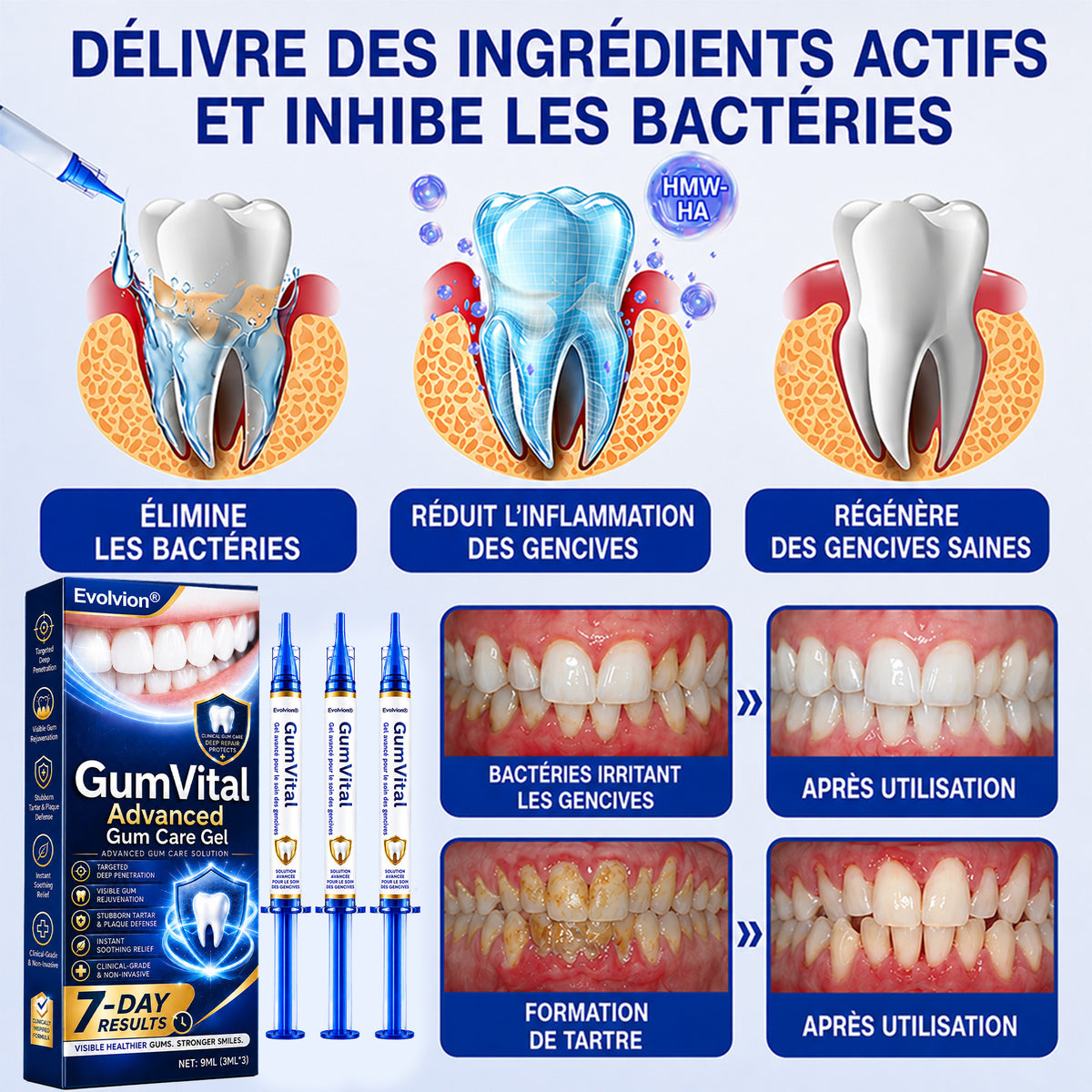 Profitez de 20 % de réduction sur le 2ᵉ article 🧡🧡