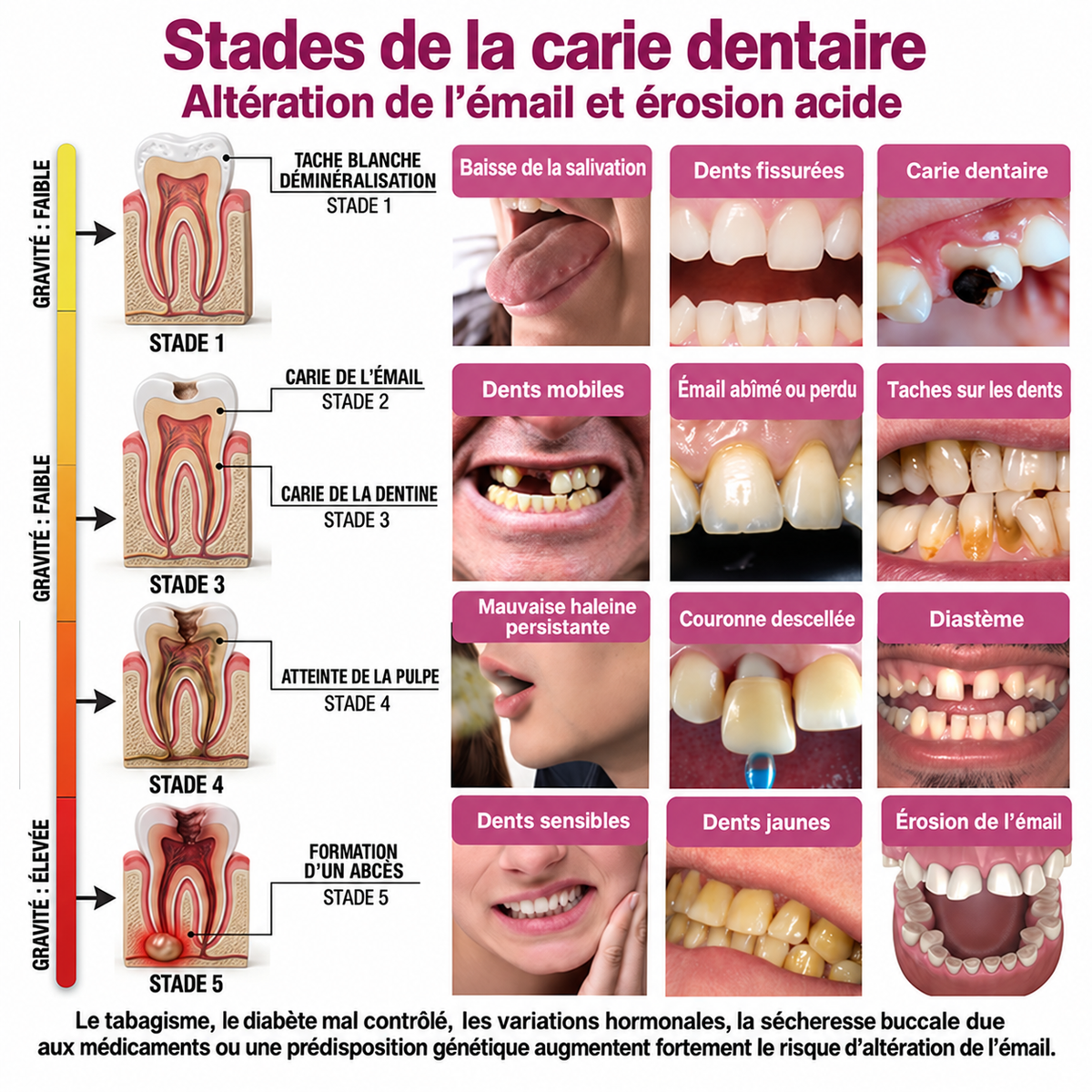 🤍 Rolimey® DenPerm – Gel de comblement naturel de l’émail pour réparer les caries