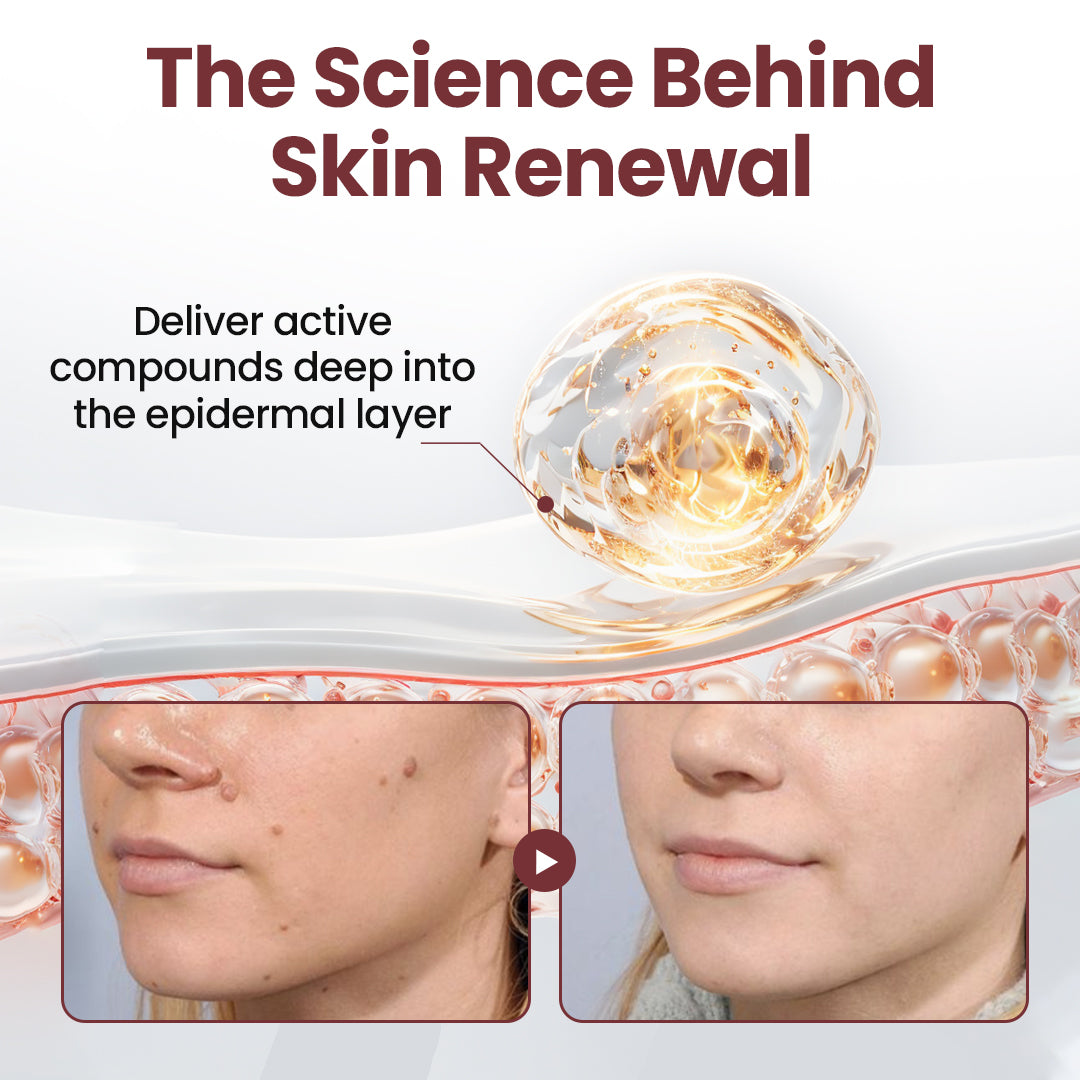 80%OFF CA Rekulo®KeraErase Dual-Action Renewal Cream👨‍⚕️ Health Canada Certified (Removes Skin Growths and Warts, Improves Actinic Keratosis and Purpura, Skin Cancer, and Age Spots) (Copy)