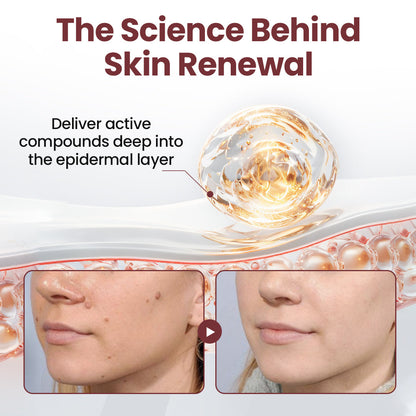 80%OFF CA Rekulo®KeraErase Dual-Action Renewal Cream👨‍⚕️ Health Canada Certified (Removes Skin Growths and Warts, Improves Actinic Keratosis and Purpura, Skin Cancer, and Age Spots) (Copy)