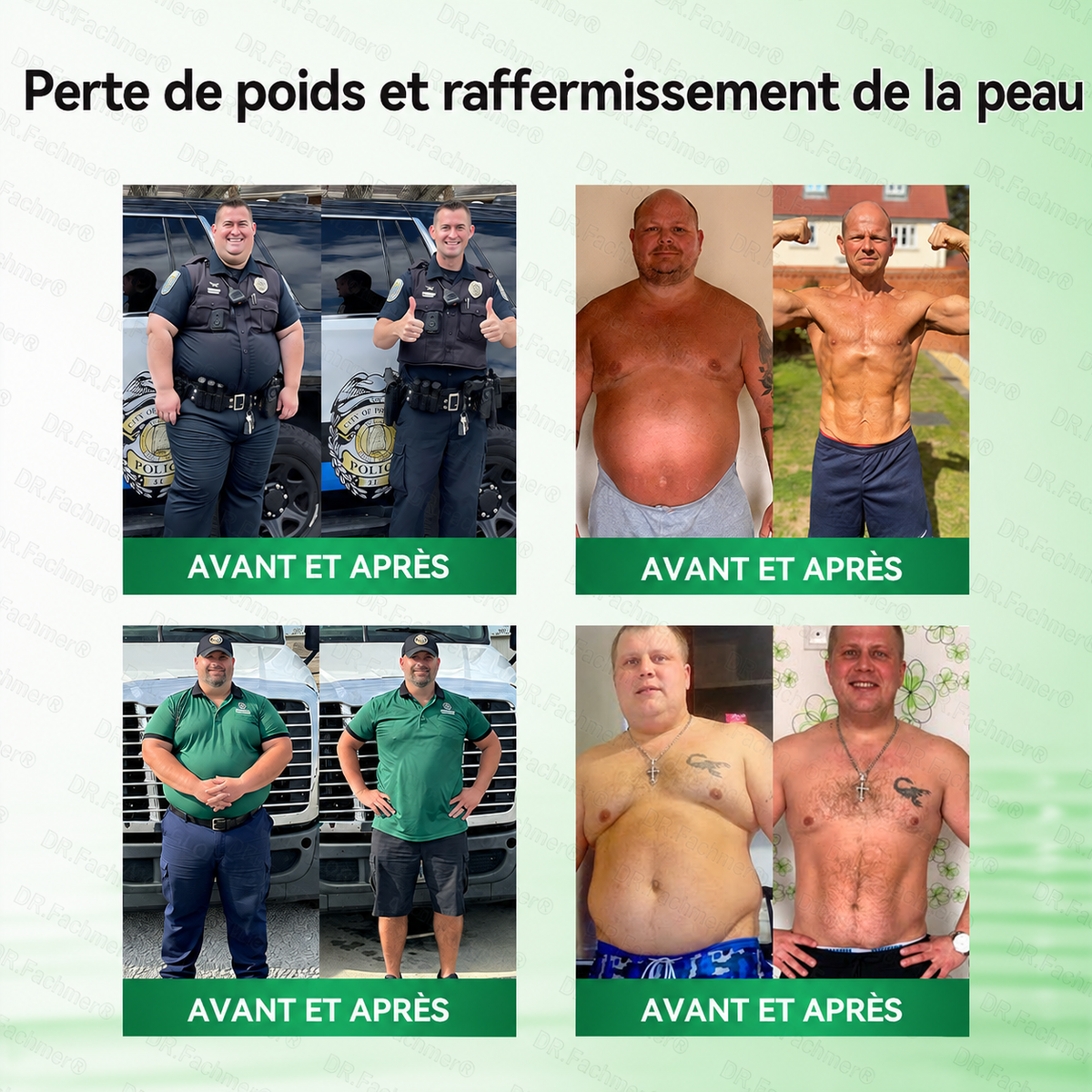 Boutique officielle | 🇫🇷⚡️DR. Fachmer® Moringa · Berbérine × NAD+ Patch Nano Microneedle 10-en-1 🇫🇷 1 fois par jour – résultats visibles en 7 jours ✅ Pour le contrôle du poids, la peau relâchée, le métabolisme et le bien-être général.