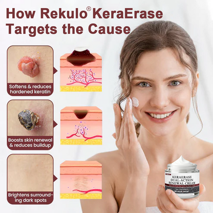 80%OFF CA Rekulo®KeraErase Dual-Action Renewal Cream👨‍⚕️ Health Canada Certified (Removes Skin Growths and Warts, Improves Actinic Keratosis and Purpura, Skin Cancer, and Age Spots) (Copy)
