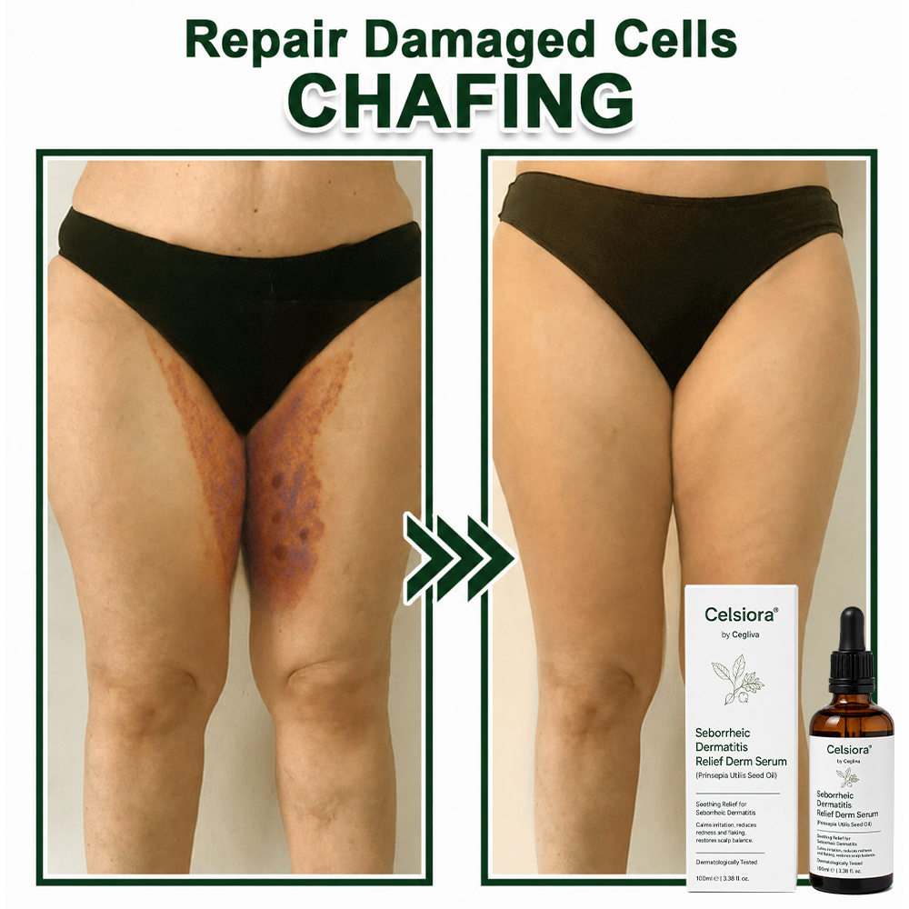🍁Celsiora® Seborrheic Dermatitis Relief Derm Serum