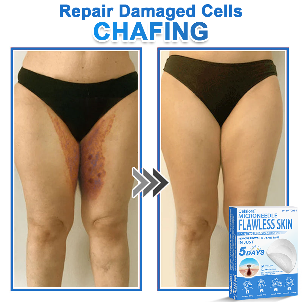 ✅Celsiora® 2-in-1 Microneedle & Hydrocolloid Patch | Raised Moles,Acne,  Flat Warts & Skin Tags Remover | Improves Wrinkles, Scars & Blemishes | Invisible Pimple Patches for Face & Body