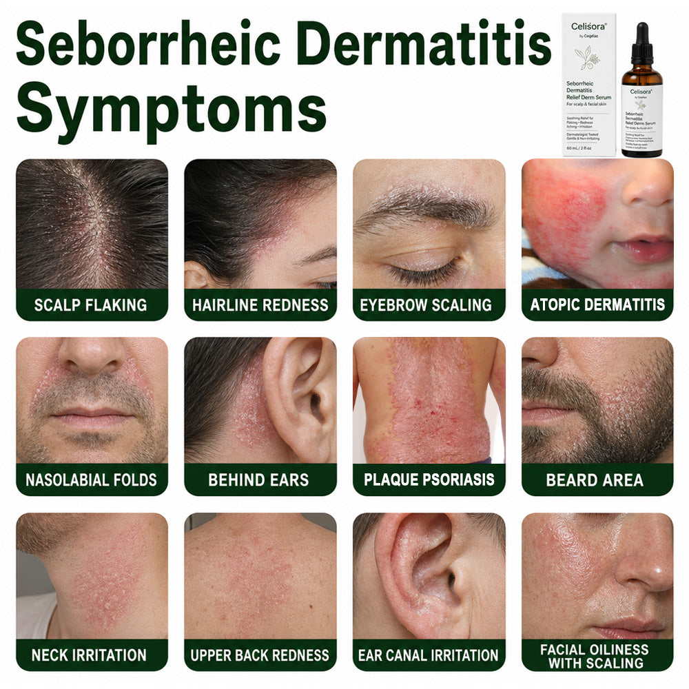 🍁Celsiora® Seborrheic Dermatitis Relief Derm Serum