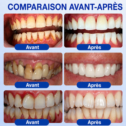 Profitez de 20 % de réduction sur le 2ᵉ article 🧡🧡
