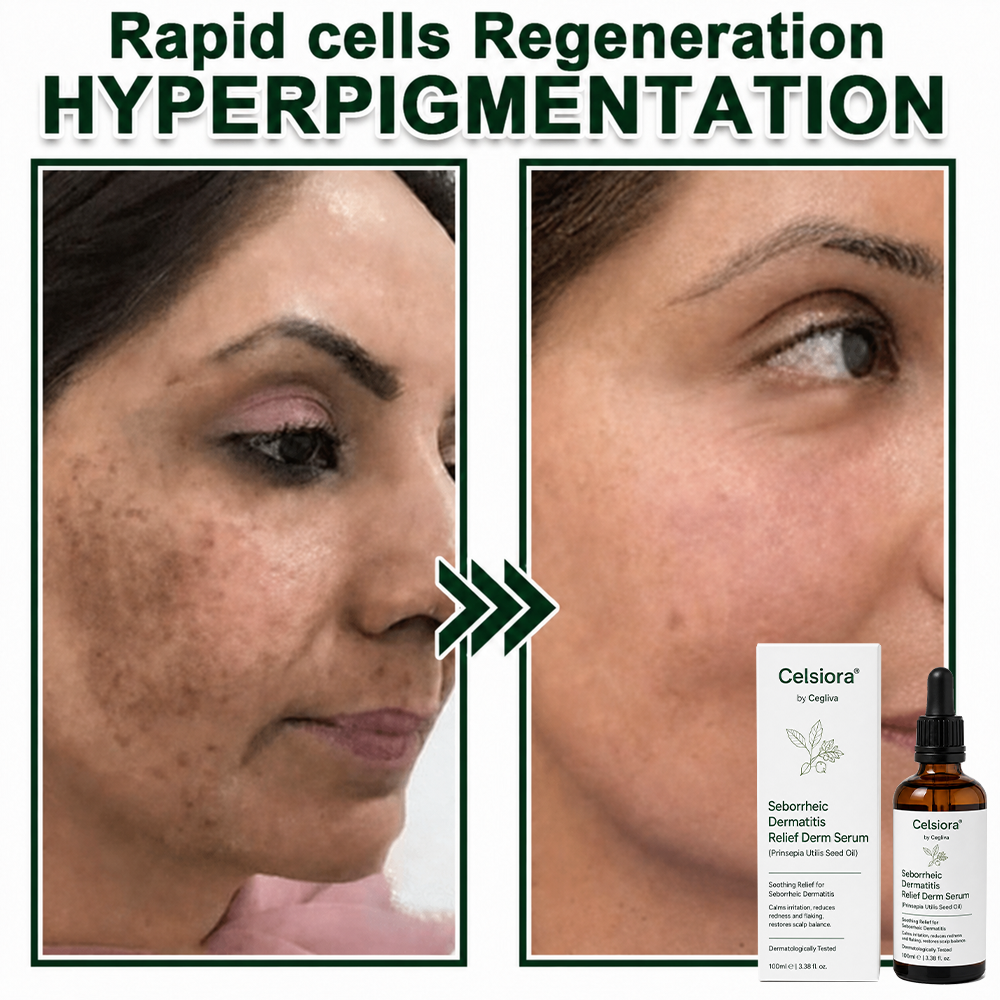 🍁Celsiora® Seborrheic Dermatitis Relief Derm Serum