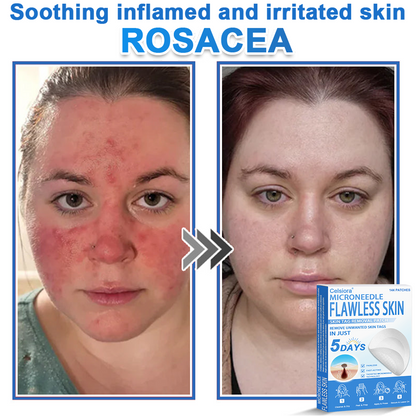 ✅Celsiora® 2-in-1 Microneedle & Hydrocolloid Patch | Raised Moles,Acne,  Flat Warts & Skin Tags Remover | Improves Wrinkles, Scars & Blemishes | Invisible Pimple Patches for Face & Body