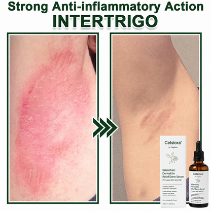 🍁Celsiora® Seborrheic Dermatitis Relief Derm Serum