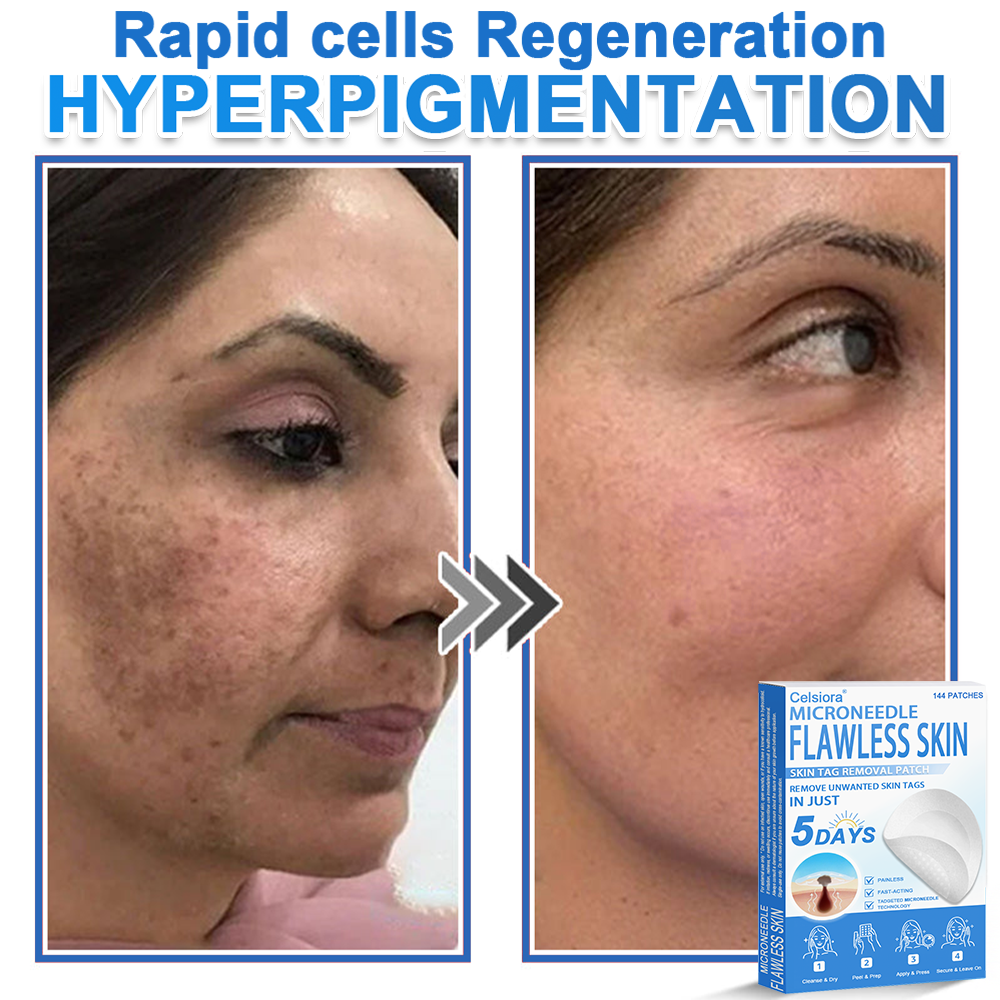 ✅Celsiora® 2-in-1 Microneedle & Hydrocolloid Patch | Raised Moles,Acne,  Flat Warts & Skin Tags Remover | Improves Wrinkles, Scars & Blemishes | Invisible Pimple Patches for Face & Body