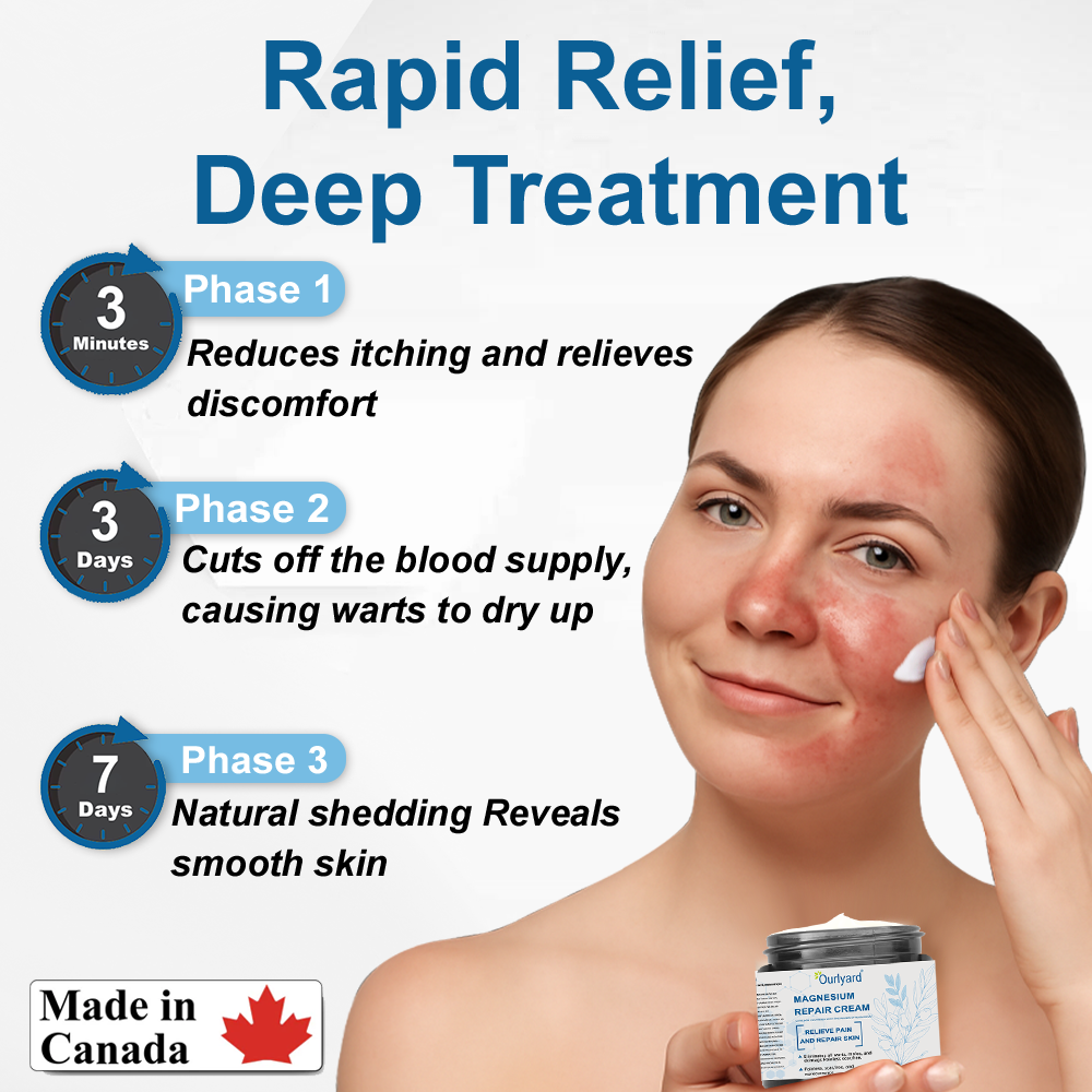 30%Discount✅Official Store: Ourlyard® Magnesium skin repair cream (Psoriasis Relief, Skin Repair, Even Tone, Acne and Dark Spot Treatment, Wart and Mole Removal)